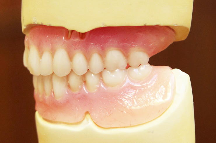 Denture referrals at C & J Dental Technologists