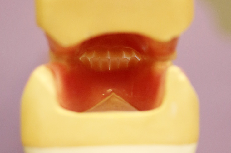 Denture referrals at C & J Dental Technologists
